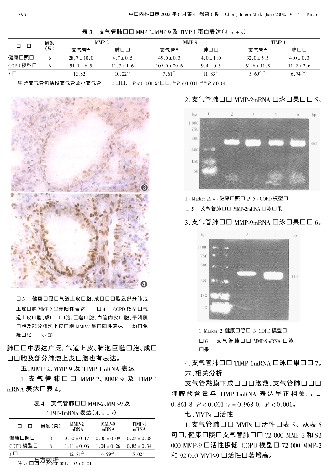 基质金属蛋白酶在大鼠慢性阻塞性肺疾病模型气道细胞外基质重塑中的作用_第4页