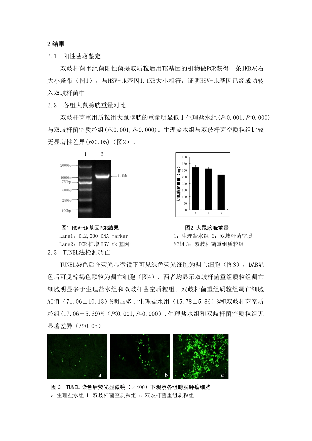 双歧杆菌介导HSV-tkGCV 治疗大鼠膀胱癌的实验研究_第5页