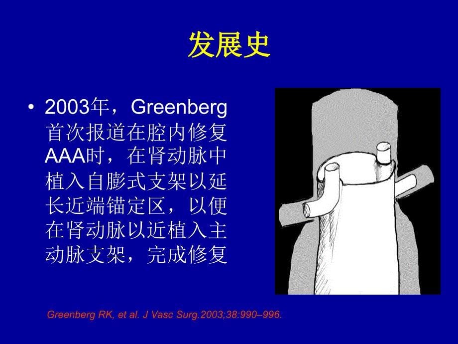 烟囱技术在血管腔内修复术中的应用_第5页