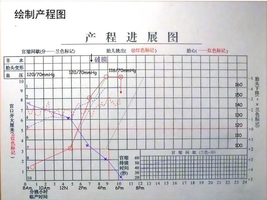 产程中母婴监测技术_第5页