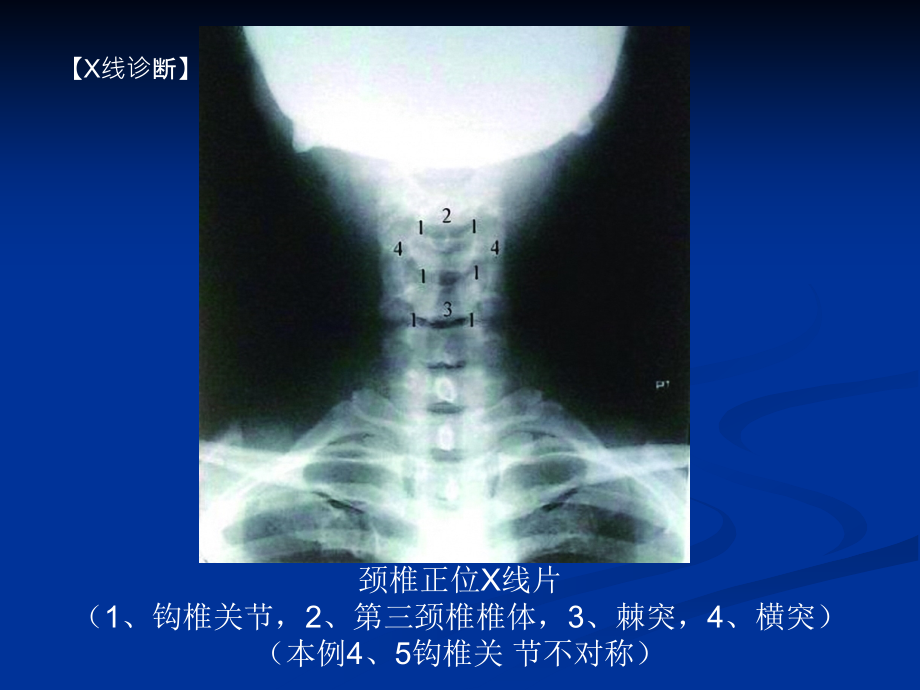 脊柱的影像学诊断_第2页