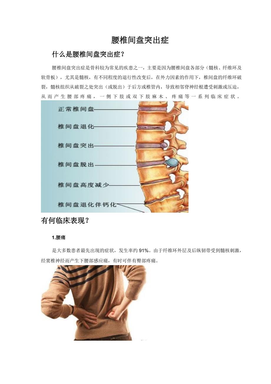 腰椎间盘突出症科普_第1页