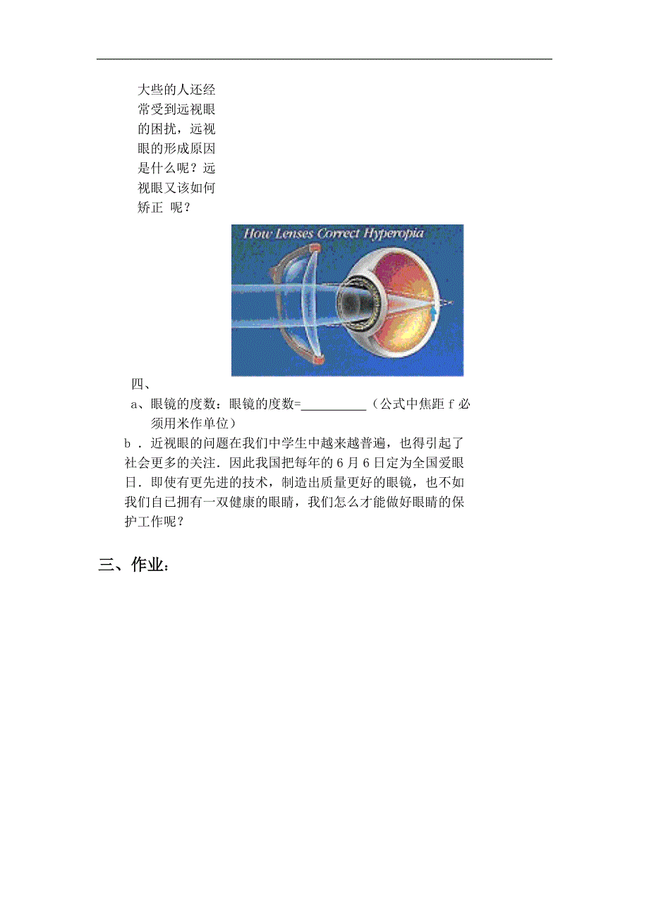 山西省广灵县第三中学八年级物理上第三章 第四节 《眼睛和眼镜》导学案_第3页