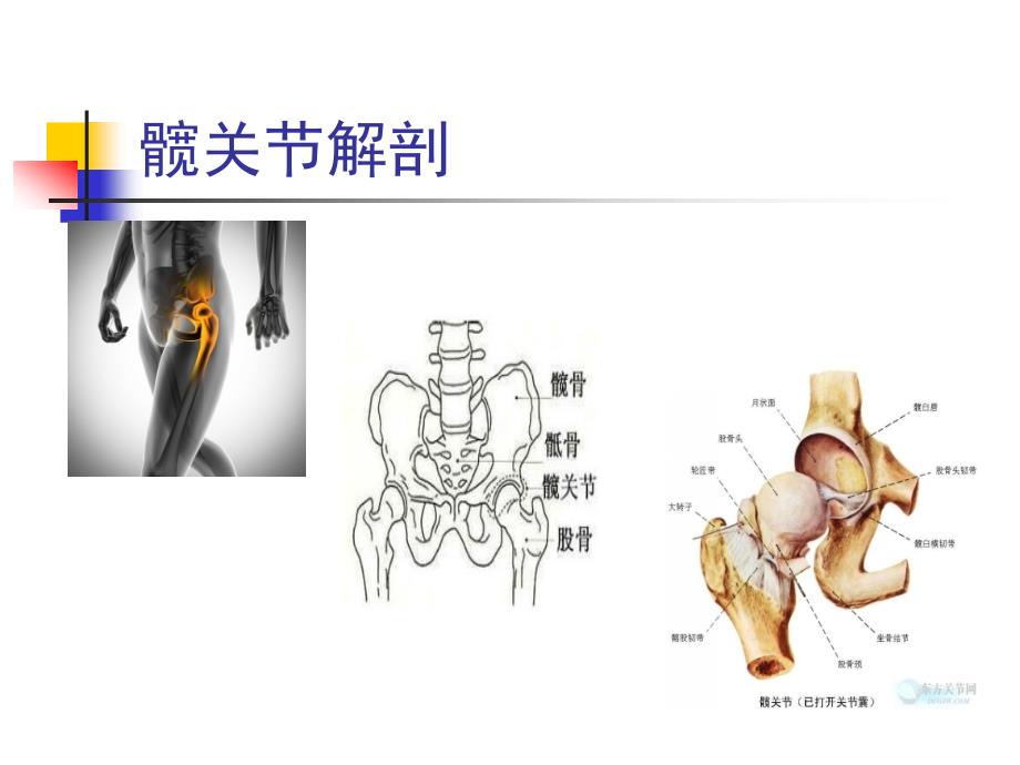 髋关节置换护理查房_第3页