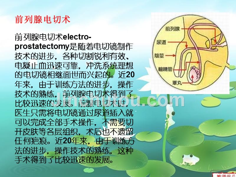 前列腺点切术术后护理_第4页