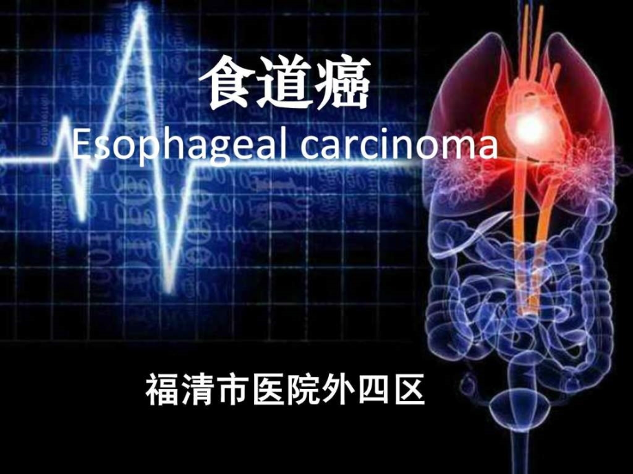 食管癌护理查房_第2页