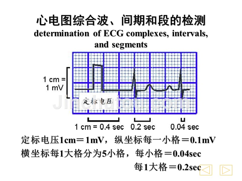 常见心电图识别._第3页