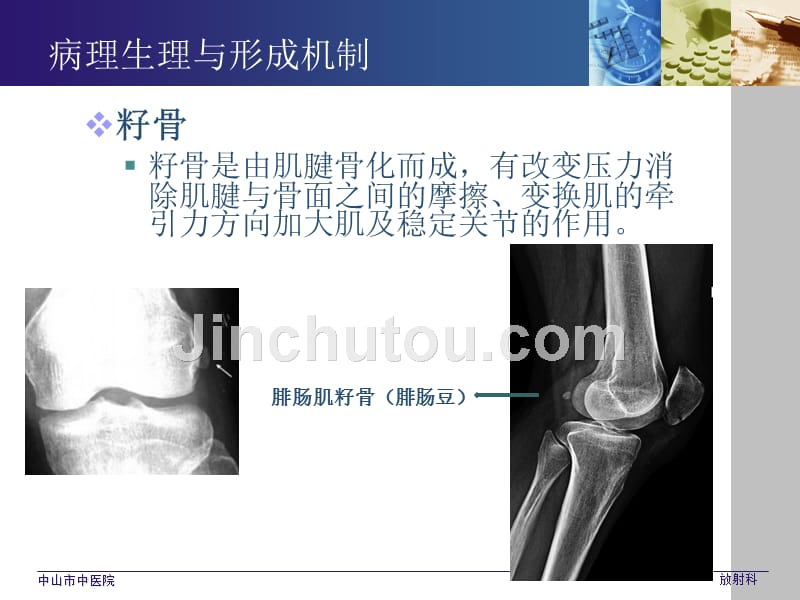 常见生理(解剖)变异与撕脱骨折的影像学鉴别_第5页