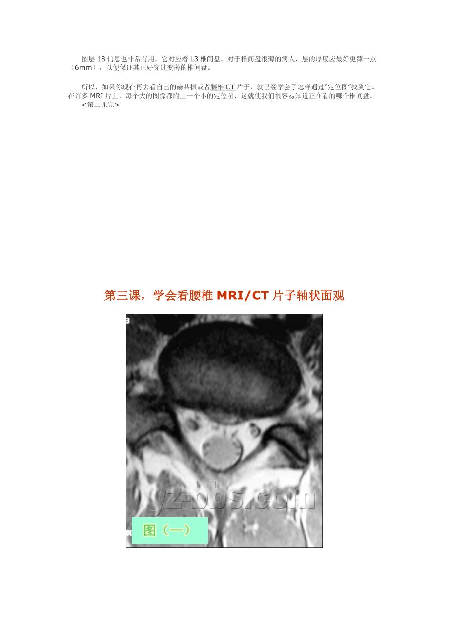 看腰椎间盘突出CT和MRI磁共振_第3页