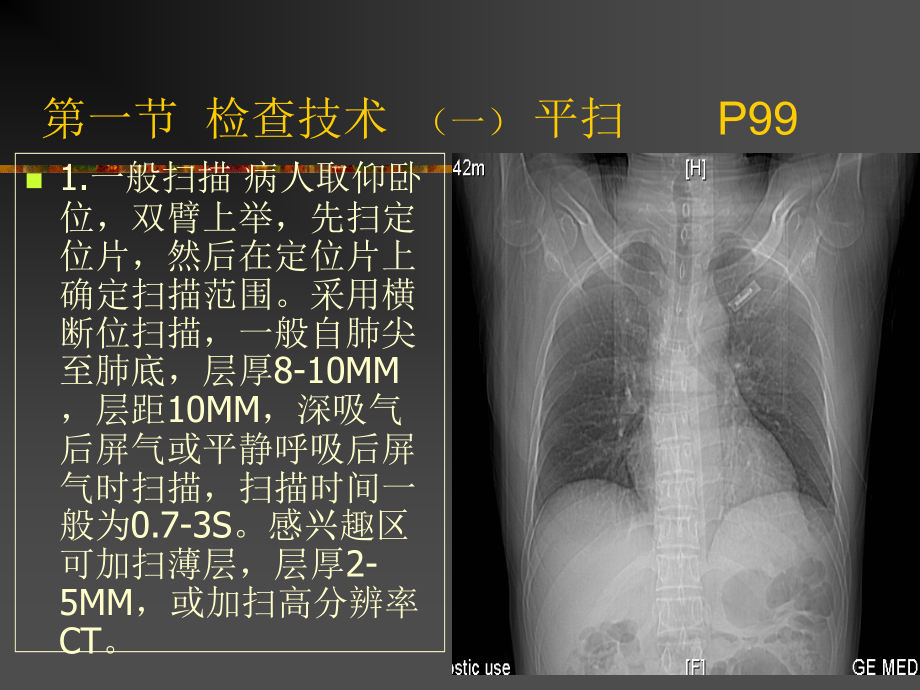 肺与纵隔2006扫描及正常_第3页