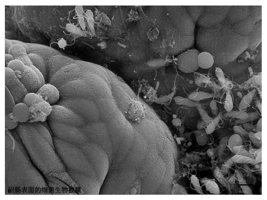 Biofilm细菌生物膜适用医学生_第5页