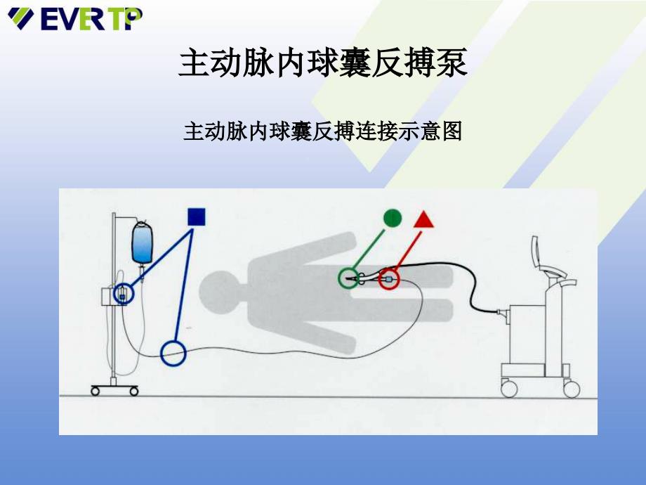 DatascopeIABP临床护理_第3页