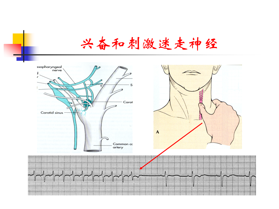 抗心律失常药物的安全性问题及稳心颗粒治疗中的优势讲稿_第3页