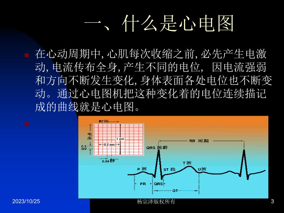 心电图PPT_第3页