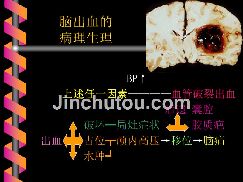 脑出血蛛网膜下腔出血教案 ppt课件_第2页