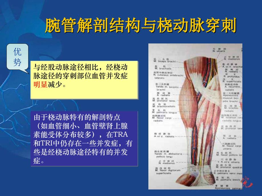 经桡动脉介入并发症及防治_第4页