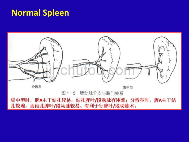 脾脏病变概述-专题讲座_第4页