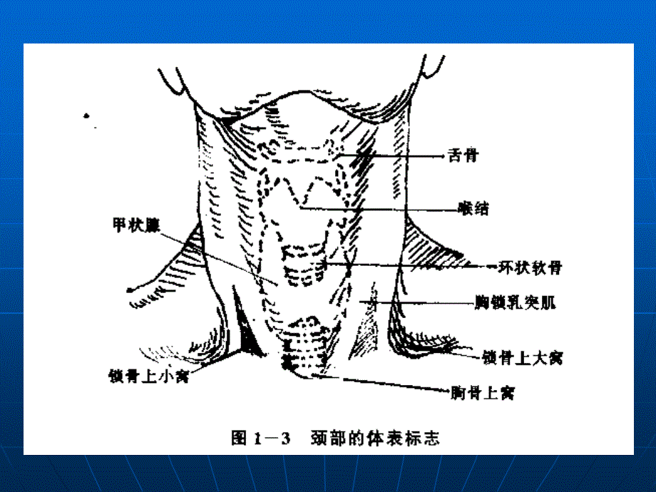 锁骨下静脉穿刺图_第3页