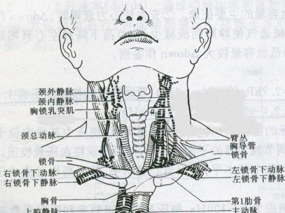 锁骨下静脉穿刺图_第4页