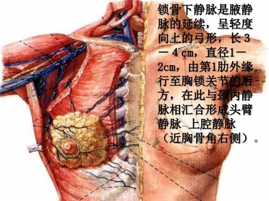 锁骨下静脉穿刺图_第5页