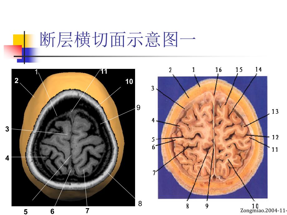 脑磁共振局部解剖与功能图谱_第4页