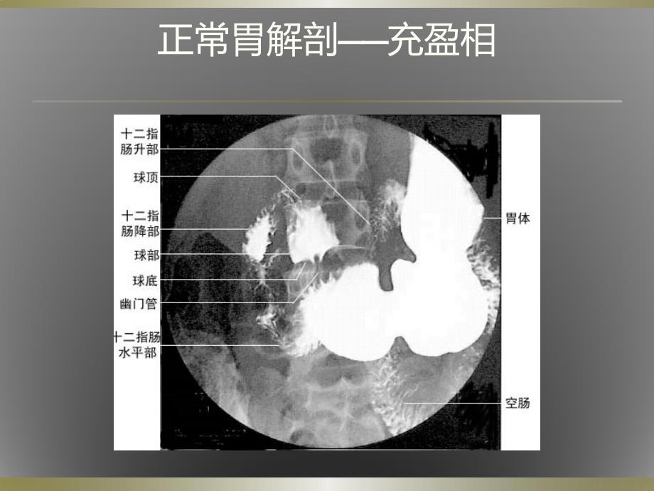 消化道钡餐-胃篇_第2页