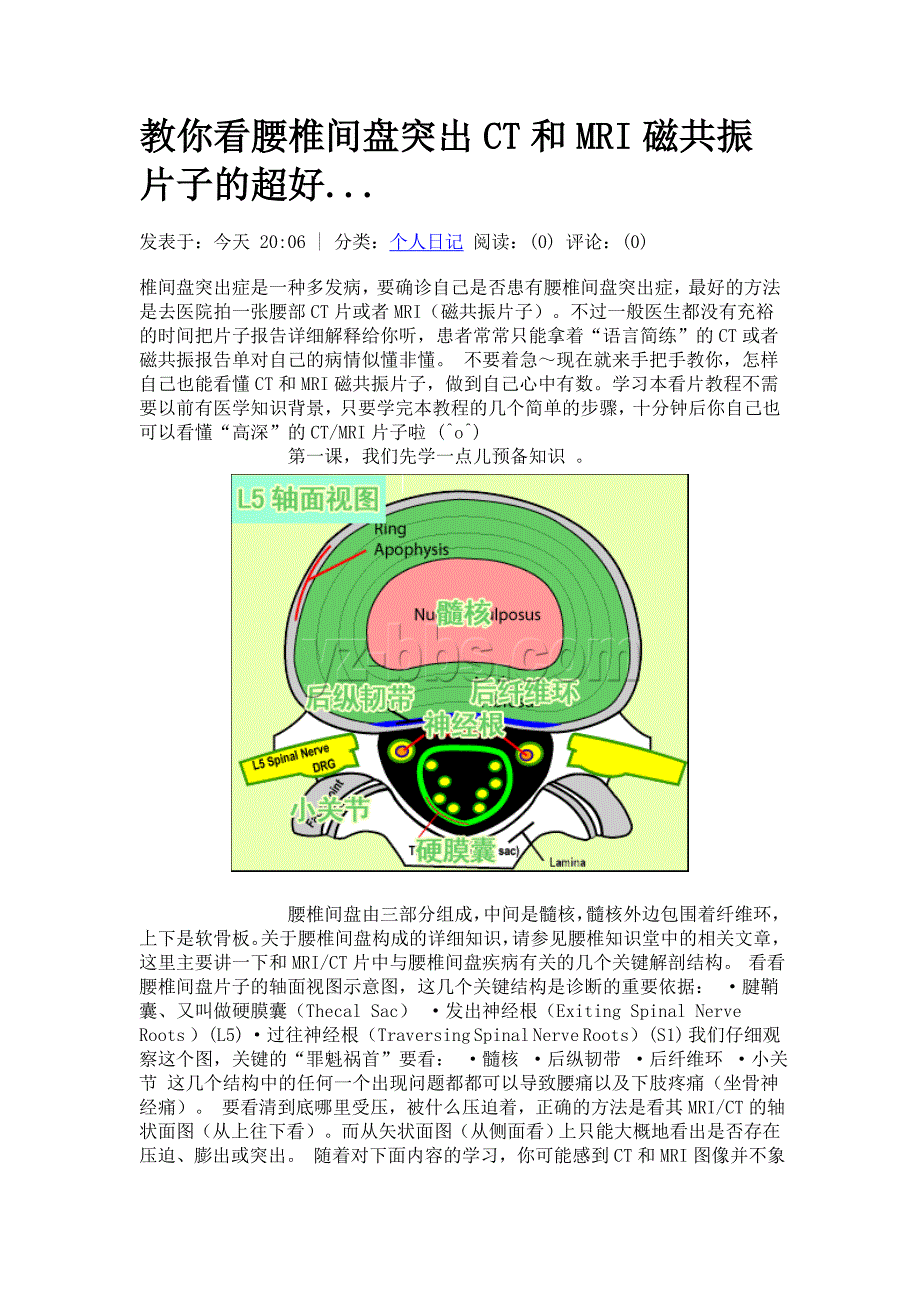 教你看腰椎间盘突出CT和MRI磁共振片子的超好_第1页