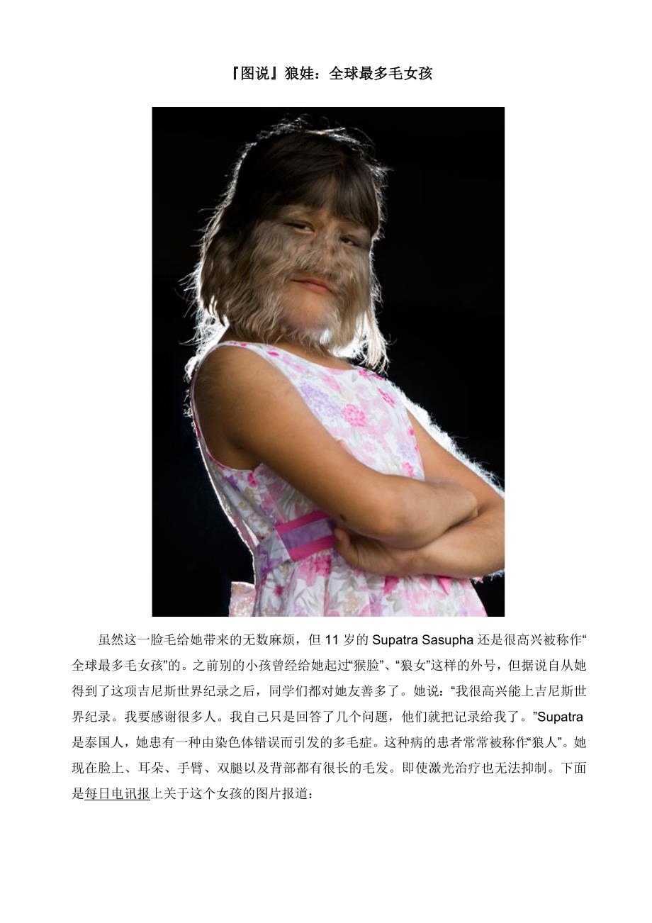 狼娃：全球最多毛女孩_第1页