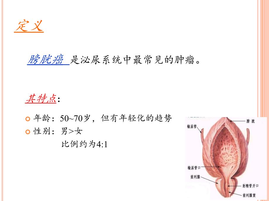 膀胱癌病人护理医学课件_第2页