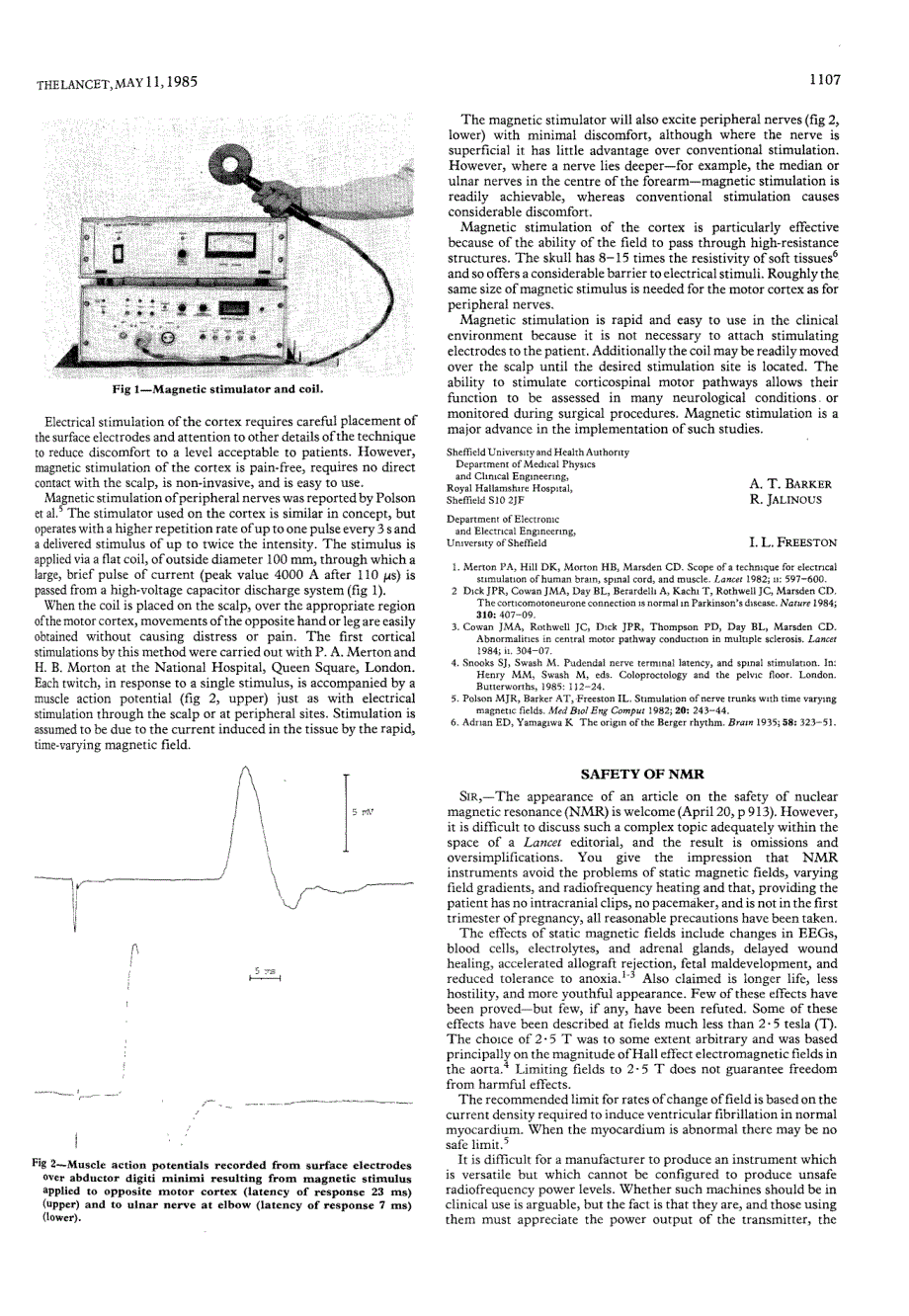 TMS经颅磁刺激运动诱发电位_第2页