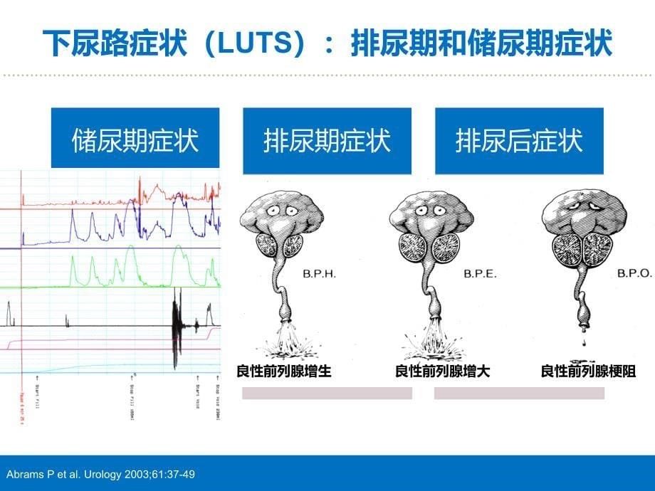 男性LUTS治疗中文版 (2)_第5页