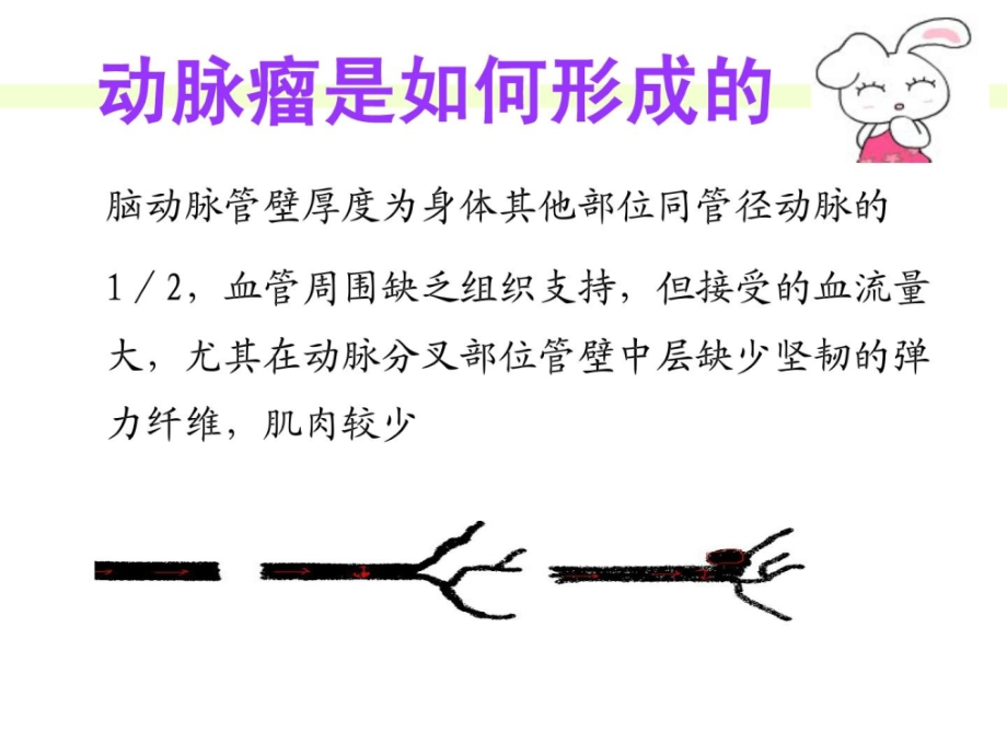 颅内动脉瘤的治疗与护理——第四军医大学唐都医院功能神经外科王学廉_第3页