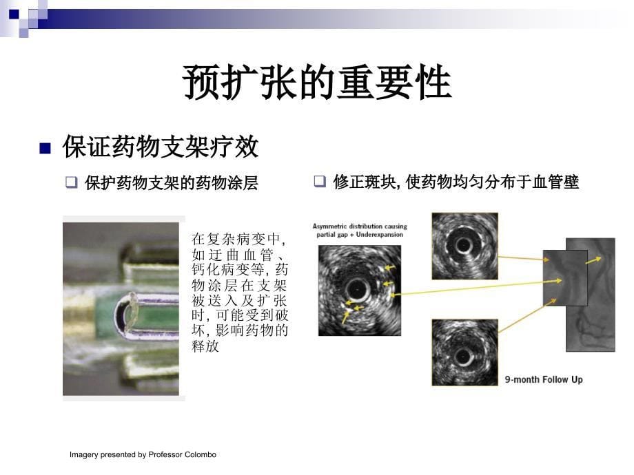 当今介入治疗中球囊的作用_第5页