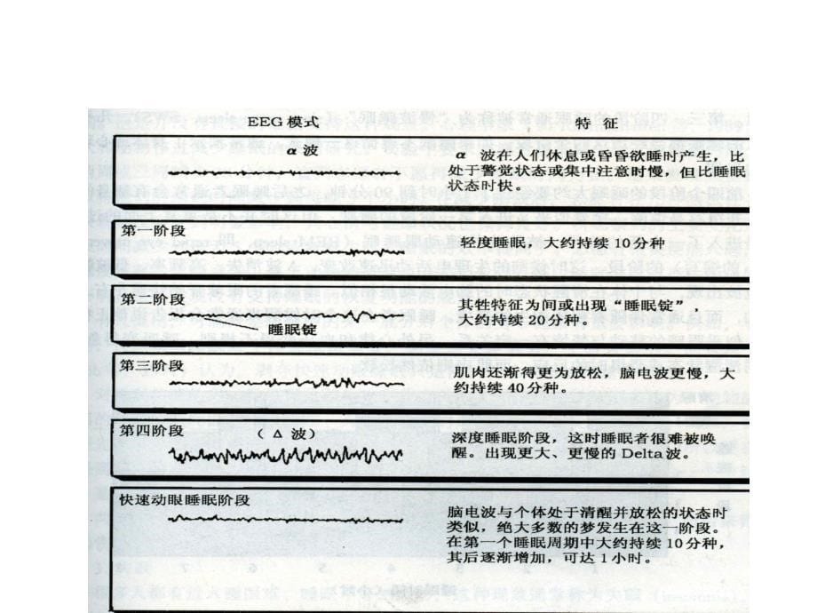 普通心理学意识与注意_第5页