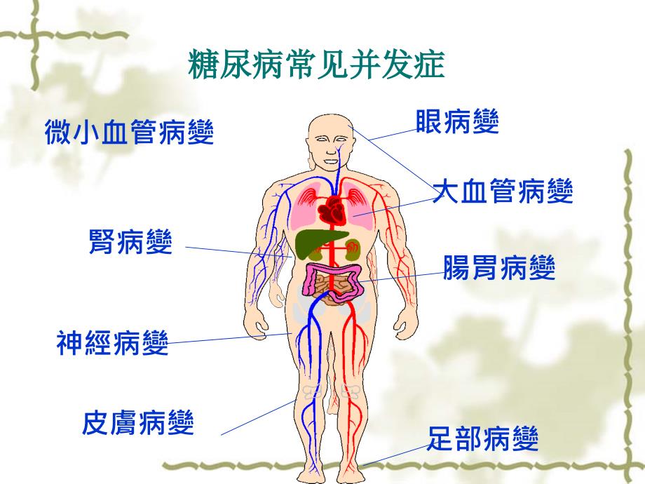 宋主任糖尿病神经并发症_第2页