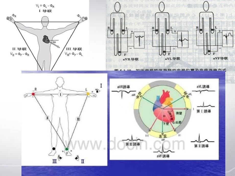 心电图讲解_第5页