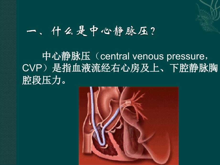 中心静脉压(CVP)的监测和护理_第3页