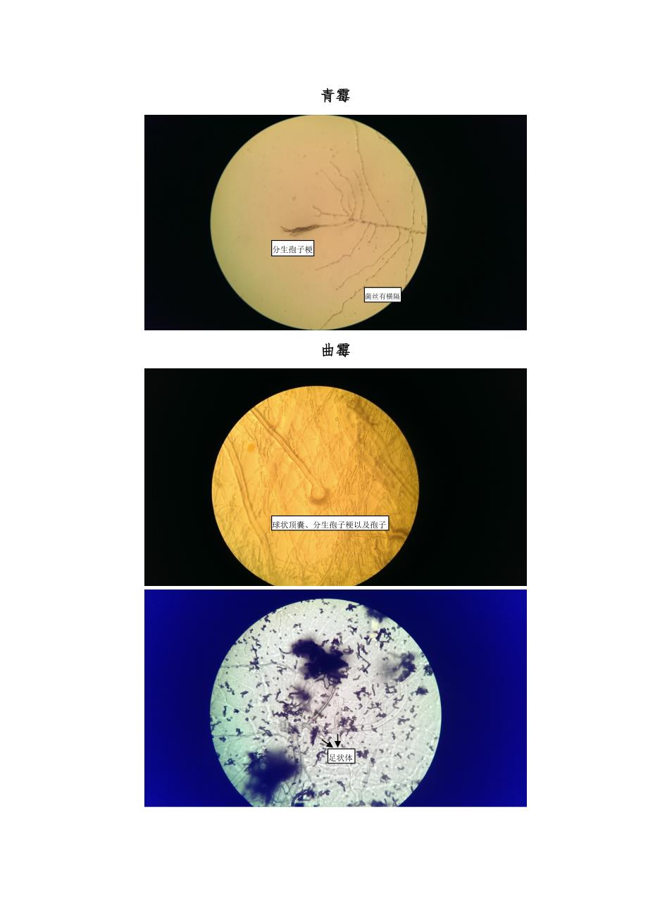 微生物学实验六 霉菌的形态观察_第3页