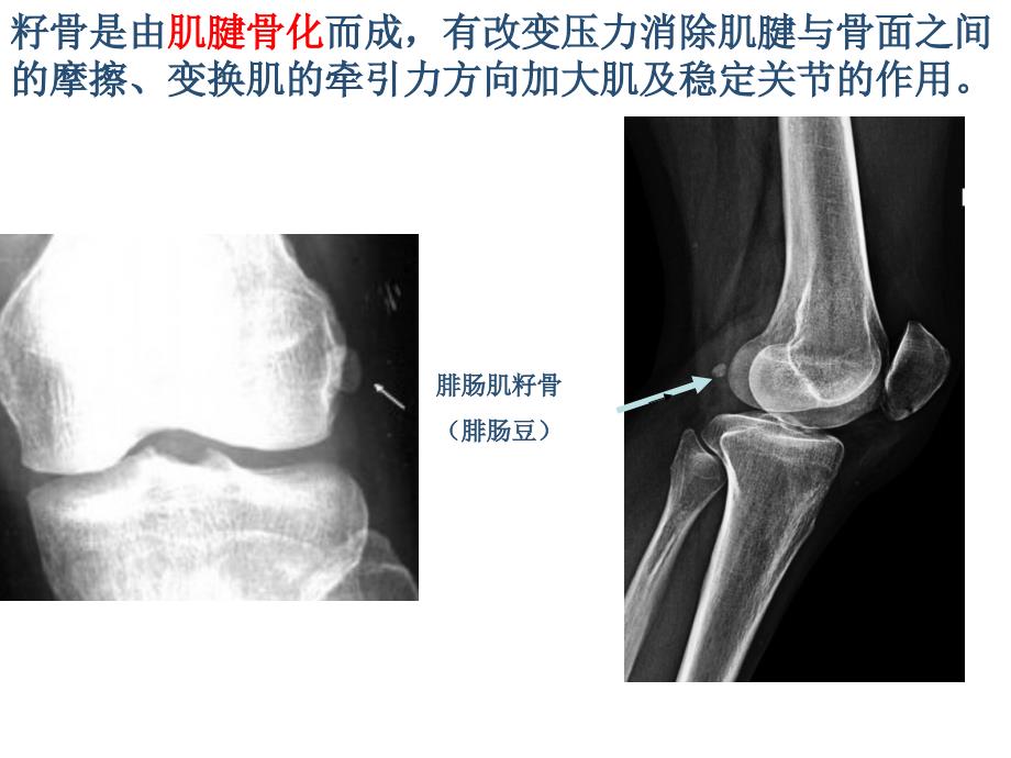 (自制)籽骨、副骨、永存_第4页