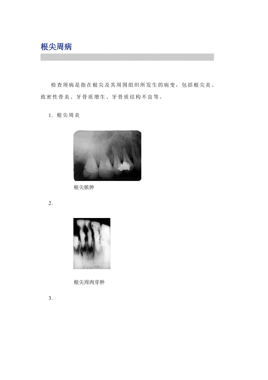 龋病牙髓病根尖周病牙周炎牙外伤牙根折断_第4页