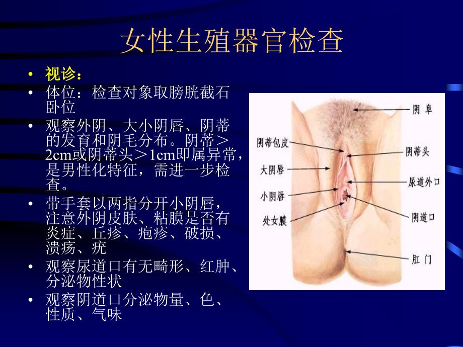 婚前检查-女性生殖器和乳房篇_第4页