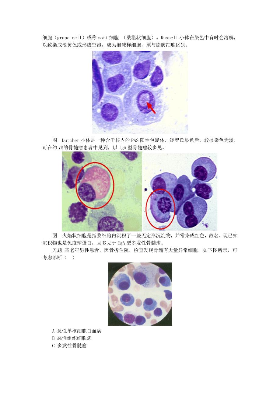 浆细胞病及其实验诊断_第2页