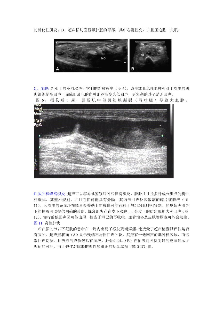 classica肌肉骨骼软组织肿块的超声评价_第4页