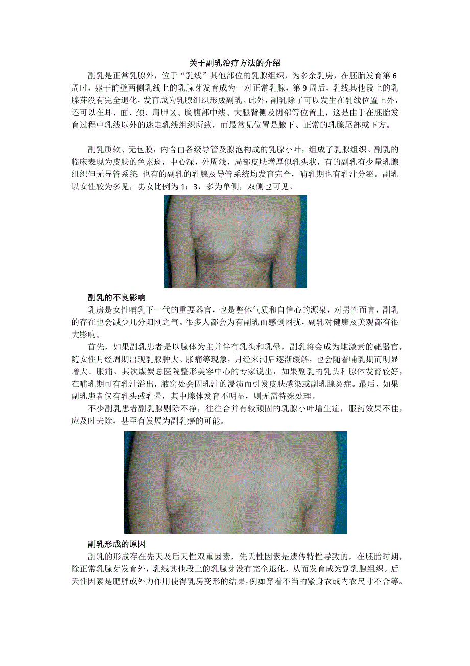 关于副乳治疗方法的介绍_第1页