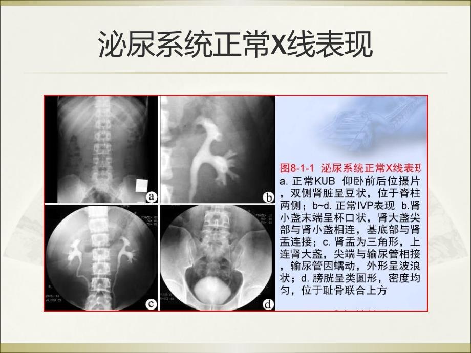 泌尿生殖系统和腹膜后间隙断层解剖_第4页