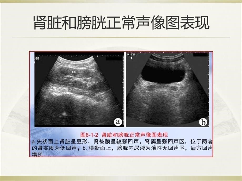 泌尿生殖系统和腹膜后间隙断层解剖_第5页