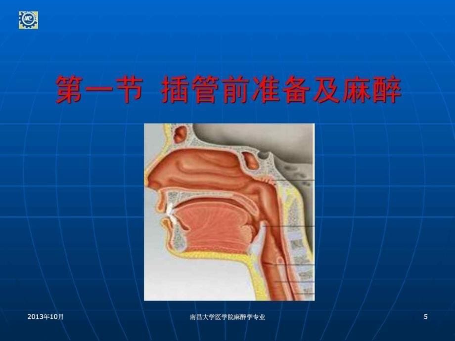 全身麻醉和气管插管_第5页