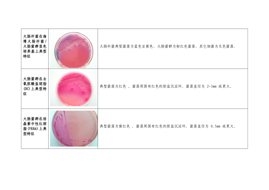 （新编）微生物菌落特征形态总结大全(带图片)_第3页