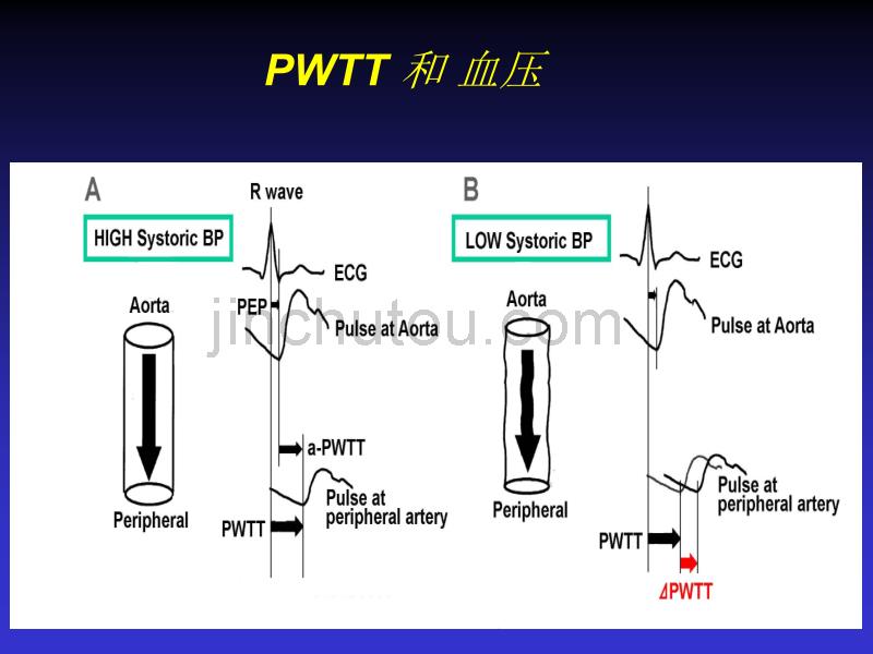 PWTT脉搏波传递时间_第5页