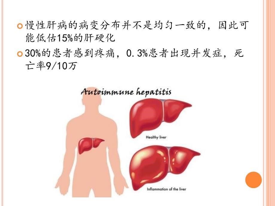 肝穿刺的意义与安全性_第5页